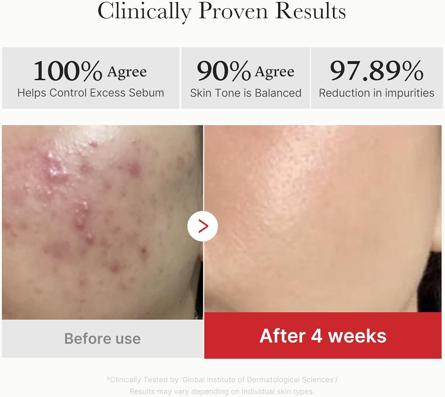 پد لایهبردار مدیکیوب Red Succinic Acid Peeling Pad