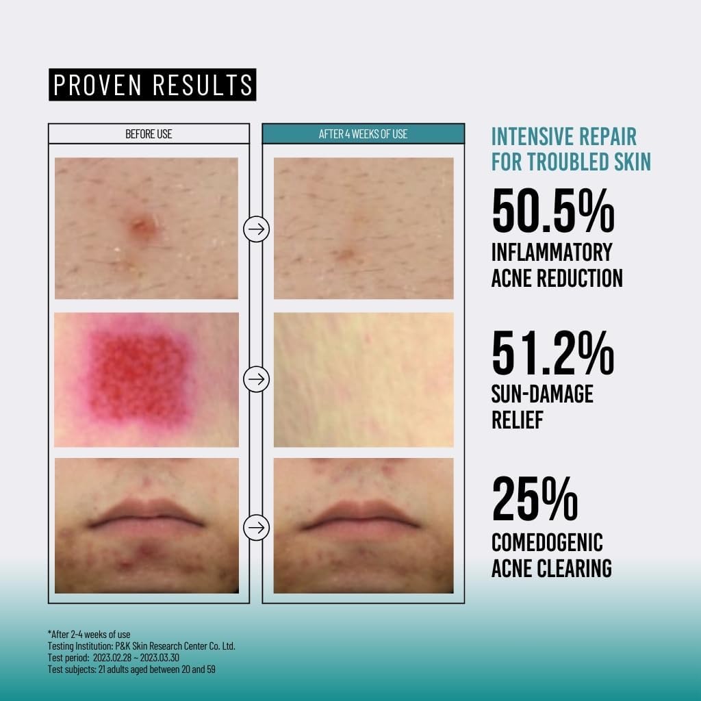 اسنس موسین حلزون 95 جومیسو PEPTIDE
