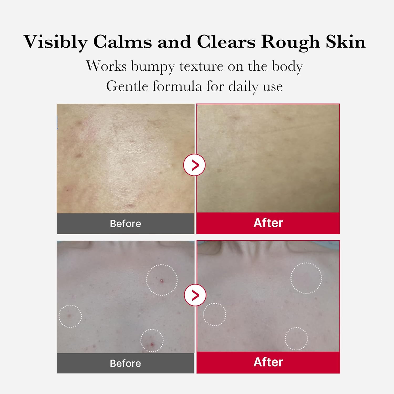 اسپری لایه بردار و ضدجوش بدن مدی کیوب Red Acne حجم 110