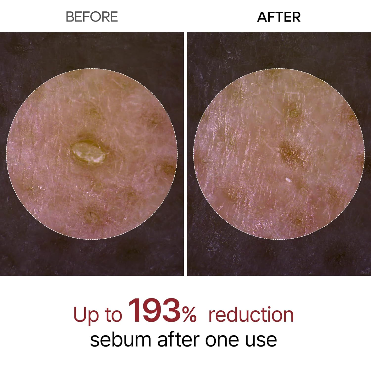 آمپول لایه بردار برنج سیاه دکتر ملاکسین Peel Shot Exfoliant