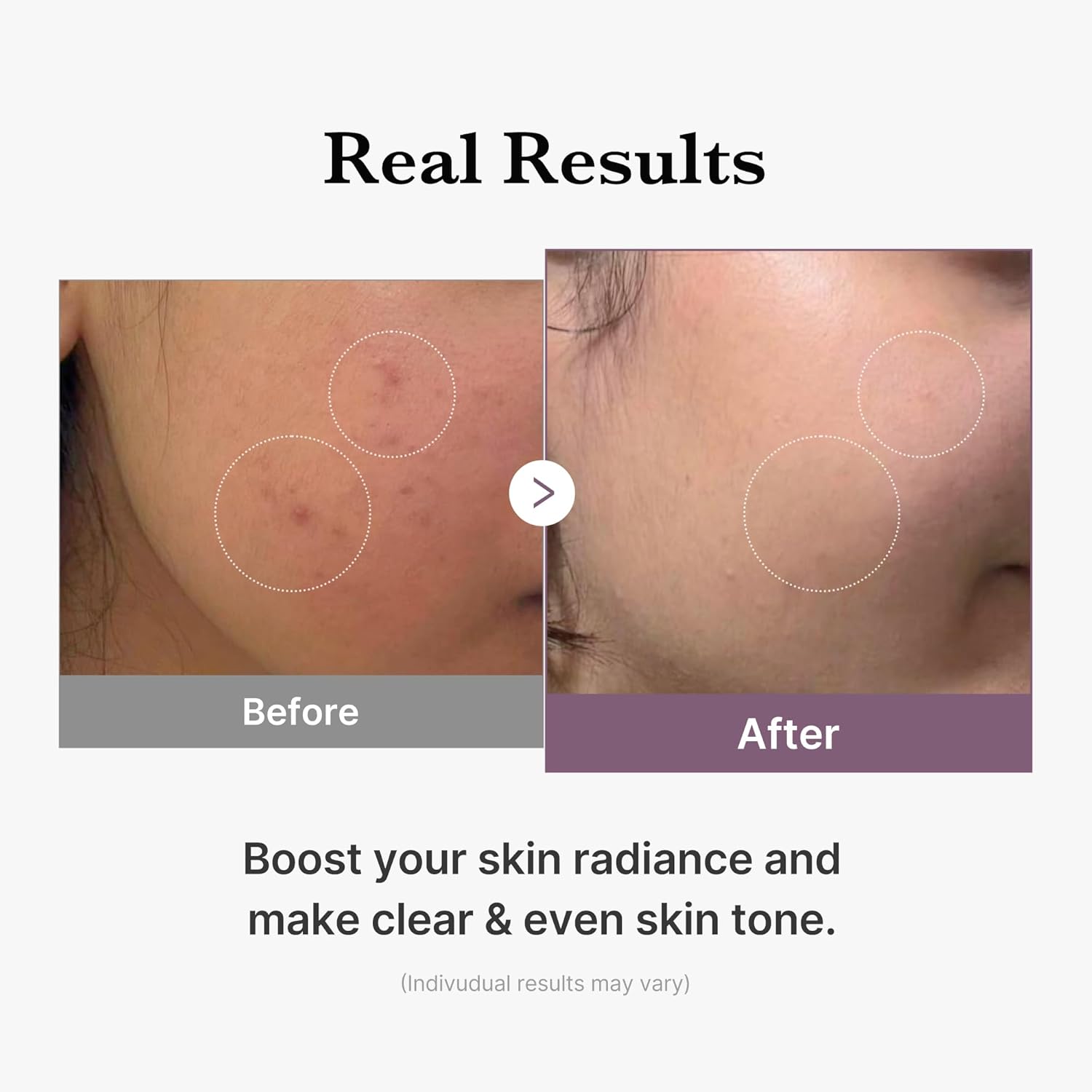 تونر روشن کننده مدی کیوب Age R Glutathione حجم 140 میل