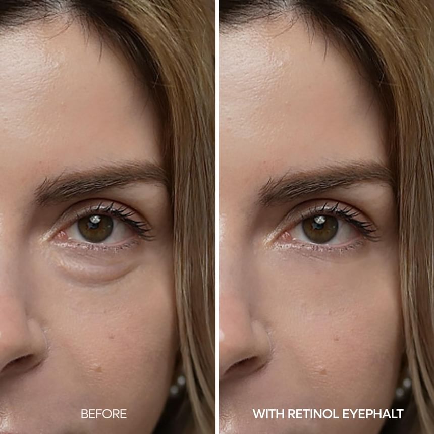 کرم دور چشم دکتر ملاکسین Eyephalt Retinol