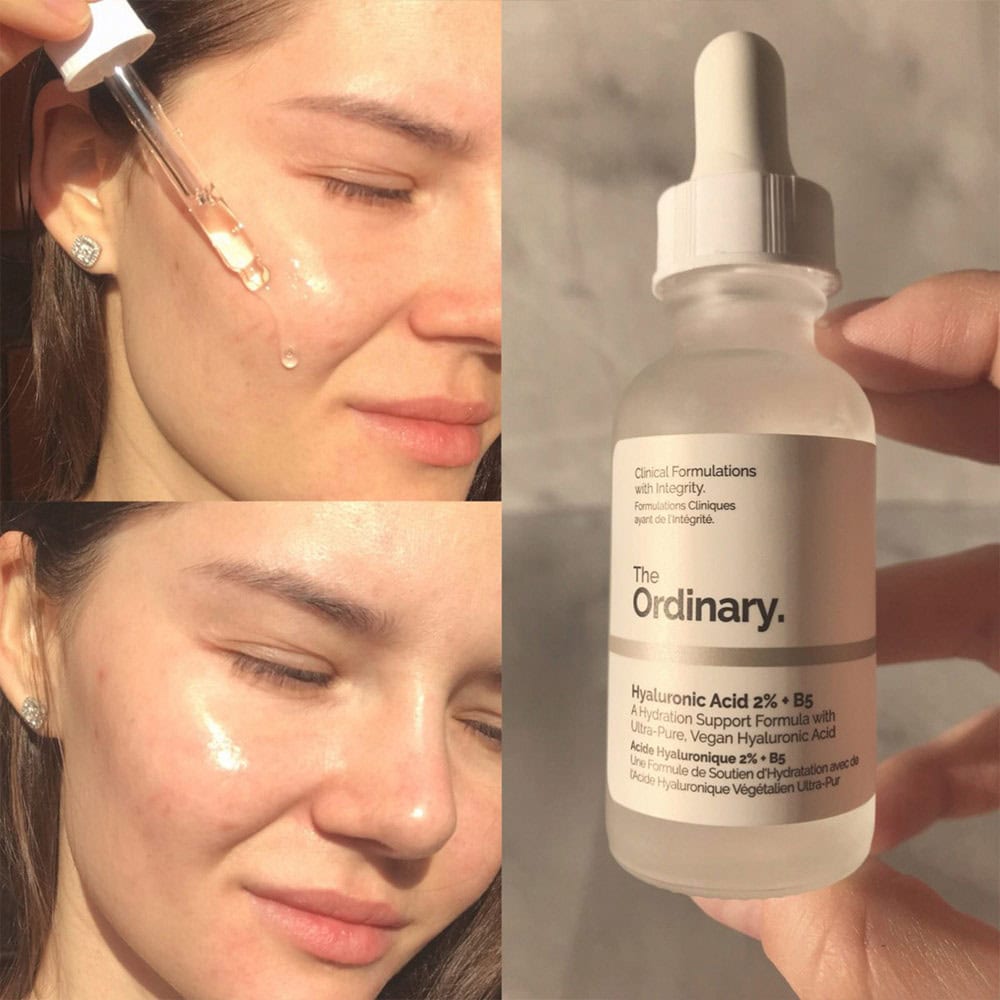 سرم آبرسان اوردینری Hyaluronic Acid