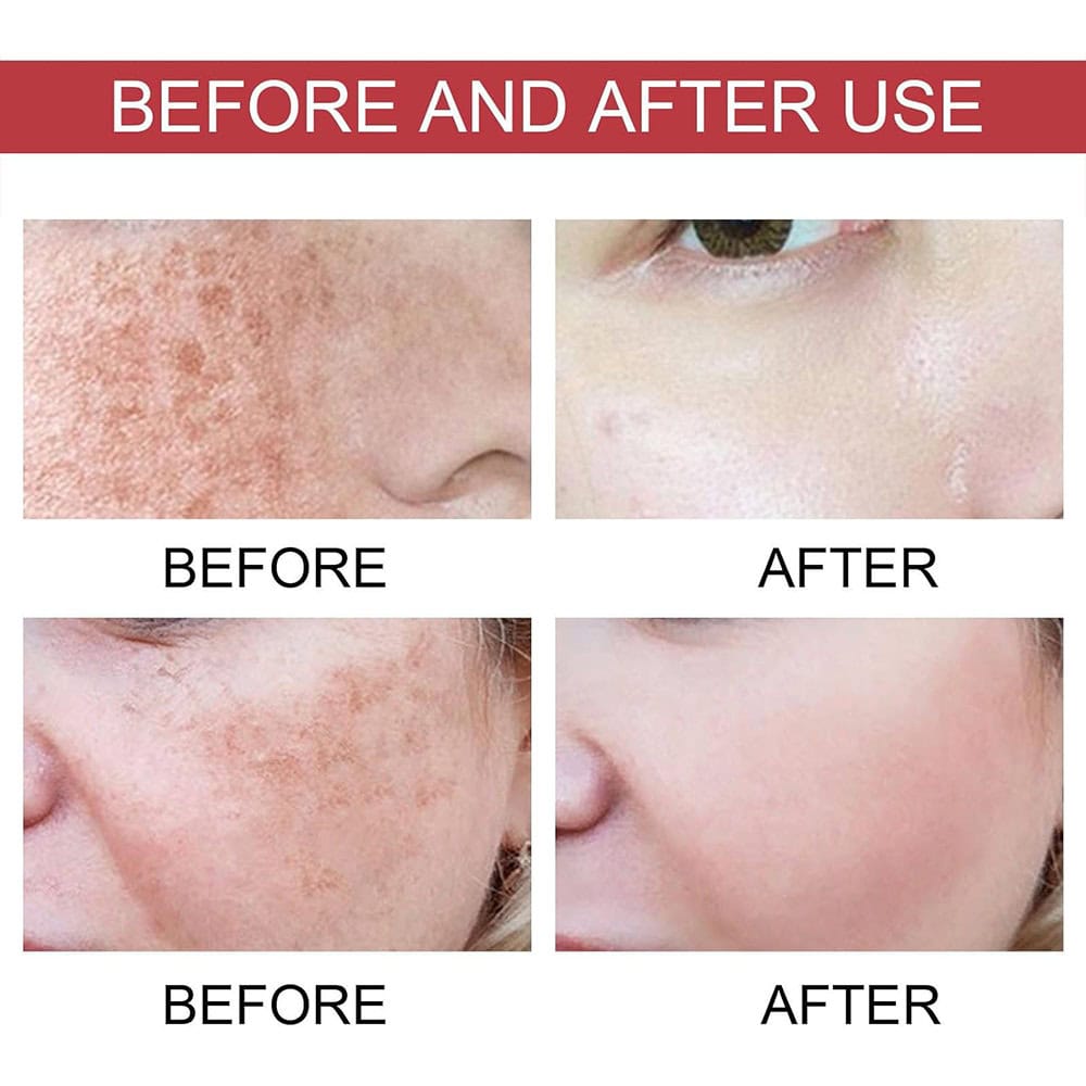 سرم ضد لک و روشنکننده آنوا Niacinamide - TXA