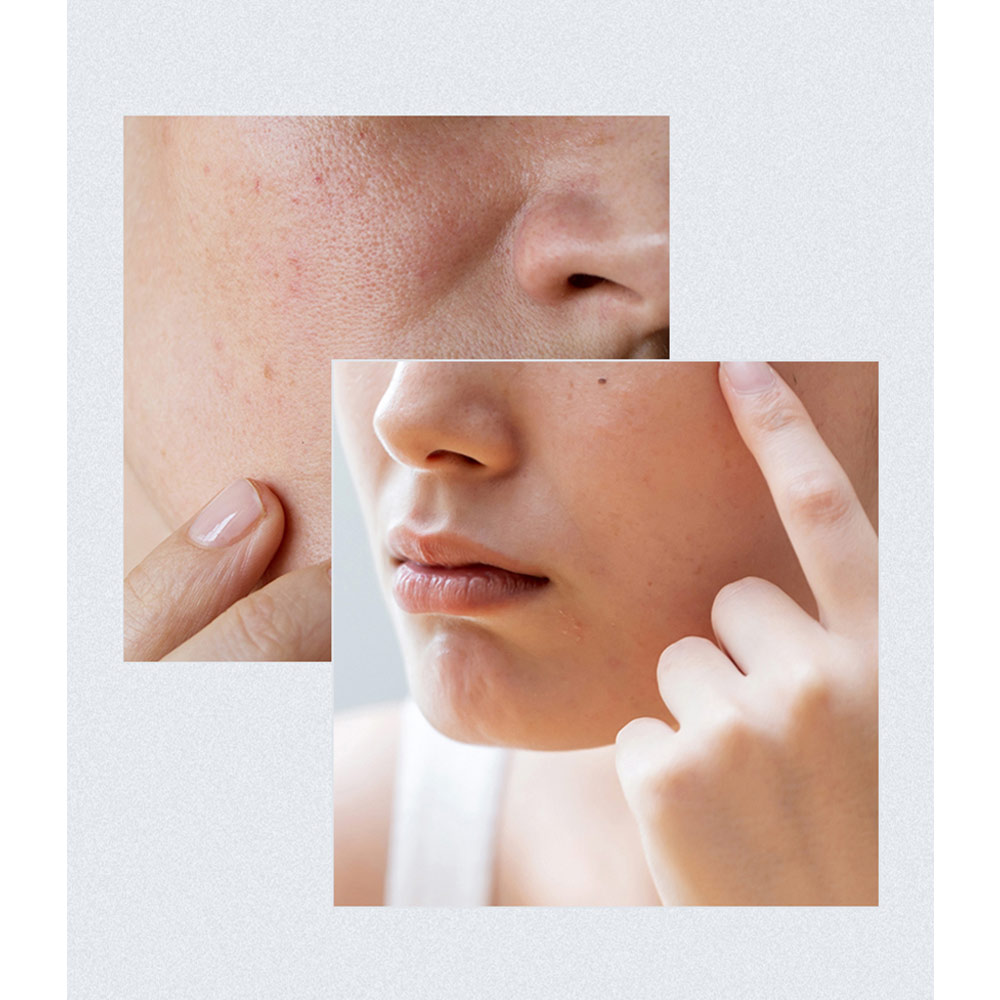 پد تقویت کننده مرطوب کننده آنوا Birch Moisture حجم 160