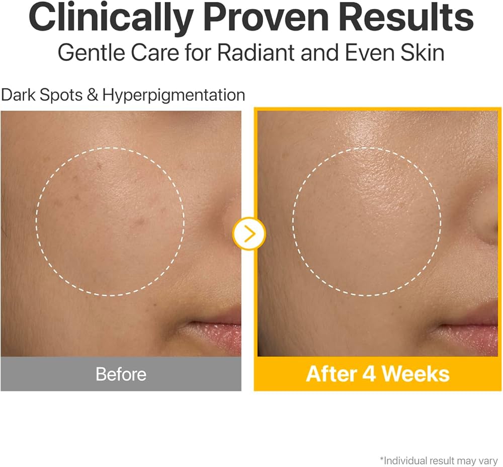 سرم ضدلک و روشن کننده نامبوزین Glutathione حجم30