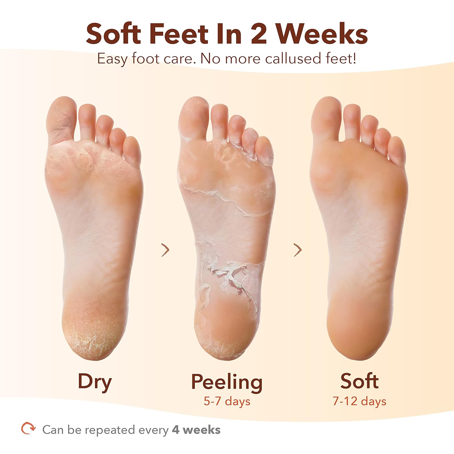 ماسک لایه بردار پا پیوردرم EXFOLIATIN